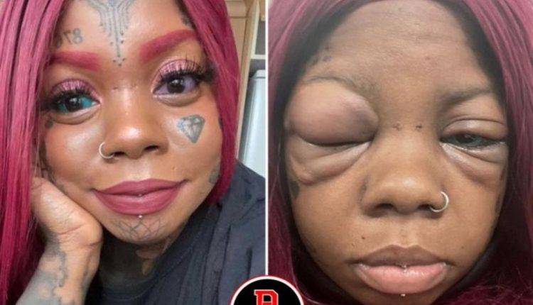 Woman Is Going Blind After Putting Tattoos On Her Eyeballs